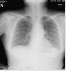 Angiography Shorts