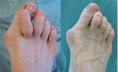 Orthopaedics Shoes